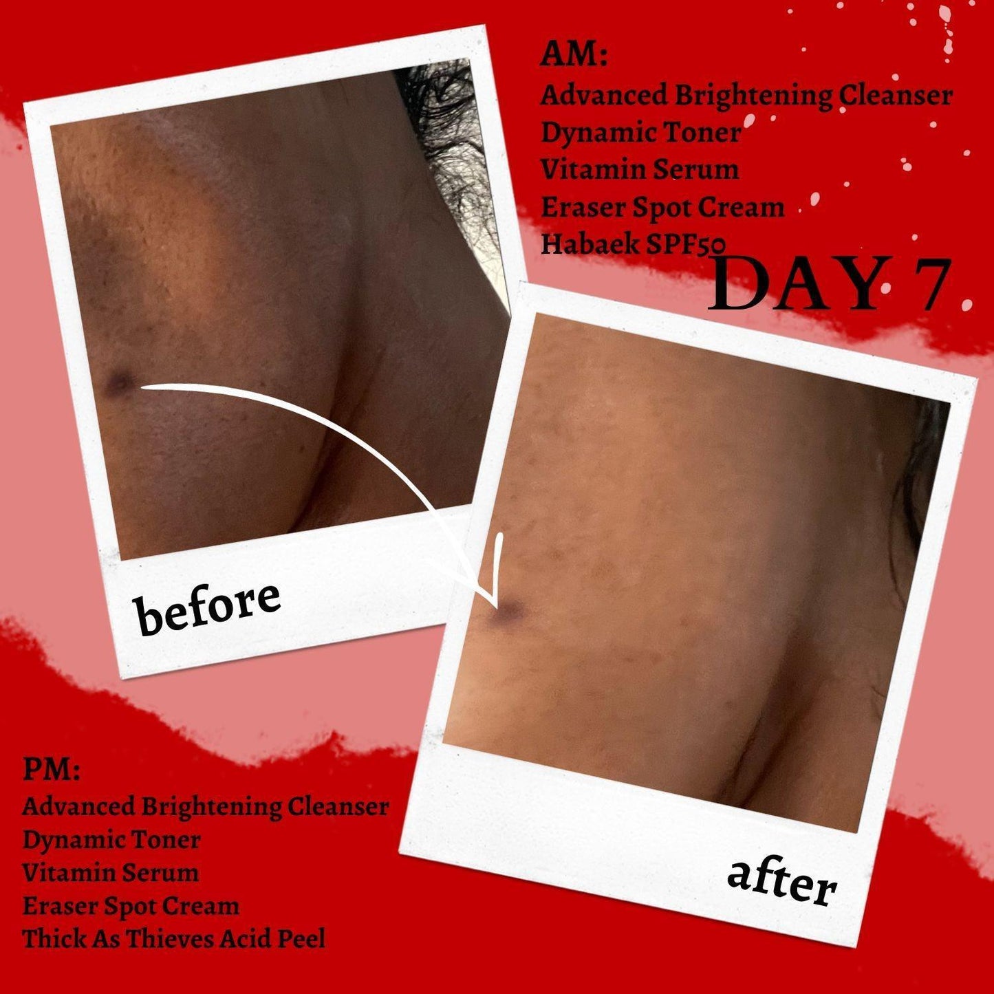Glycolic + Lactic Acid Resurfacing Peel