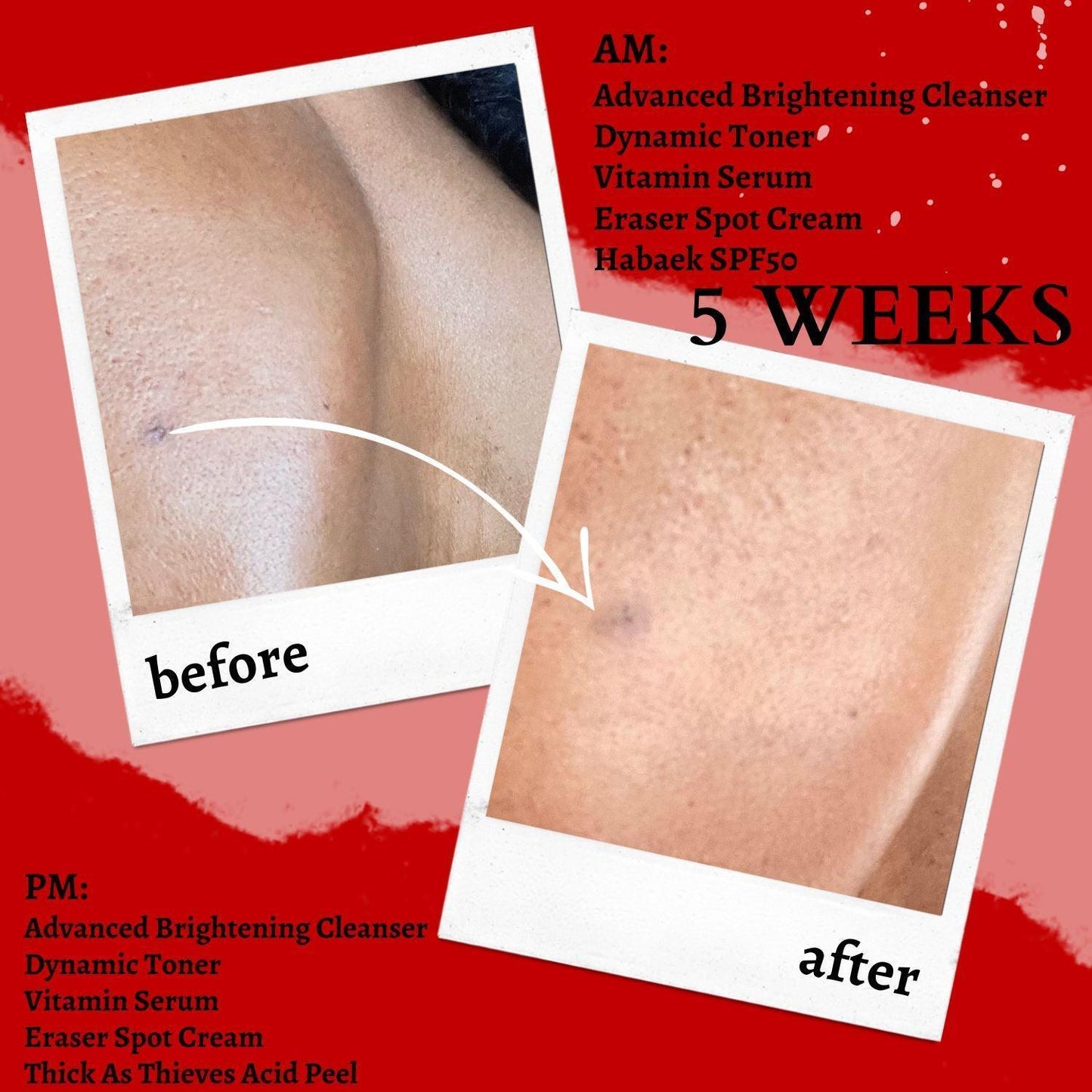 Glycolic + Lactic Acid Resurfacing Peel