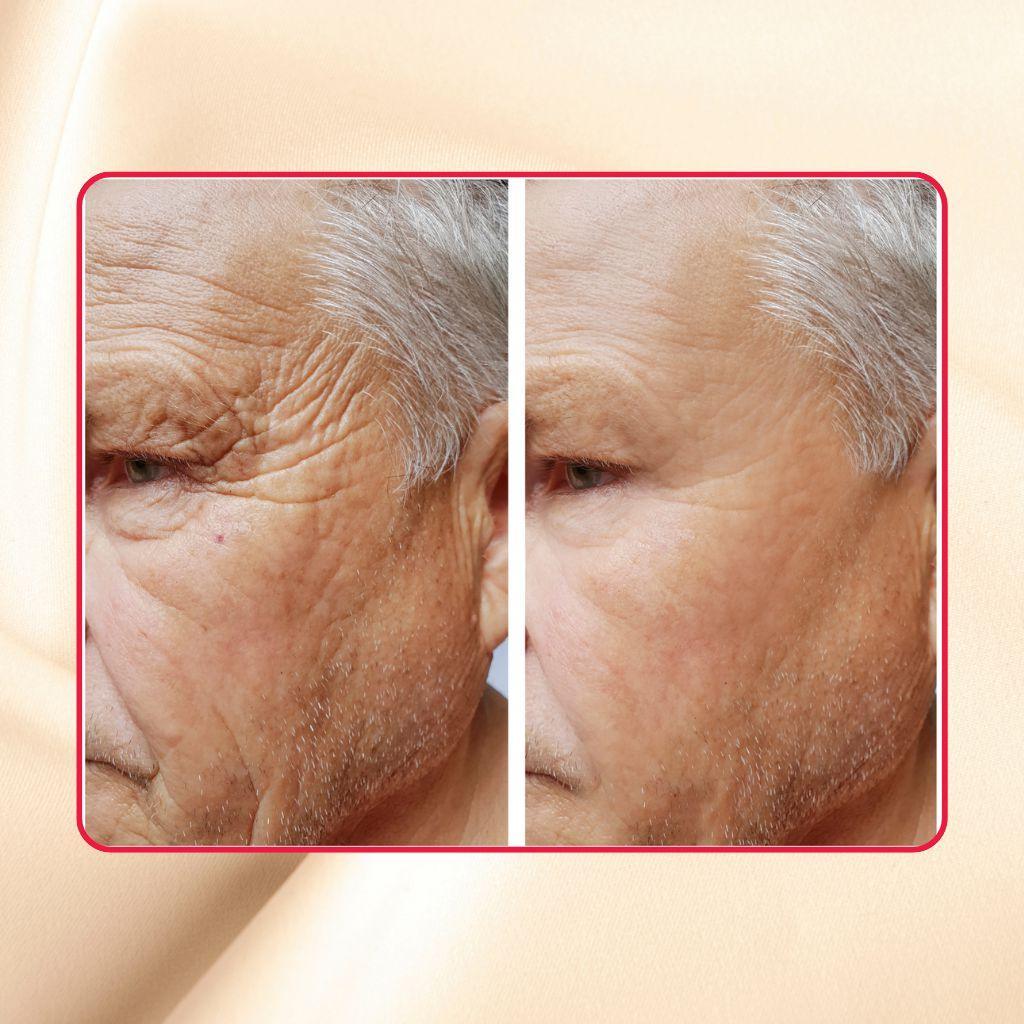 Glycolic + Lactic Acid Resurfacing Peel