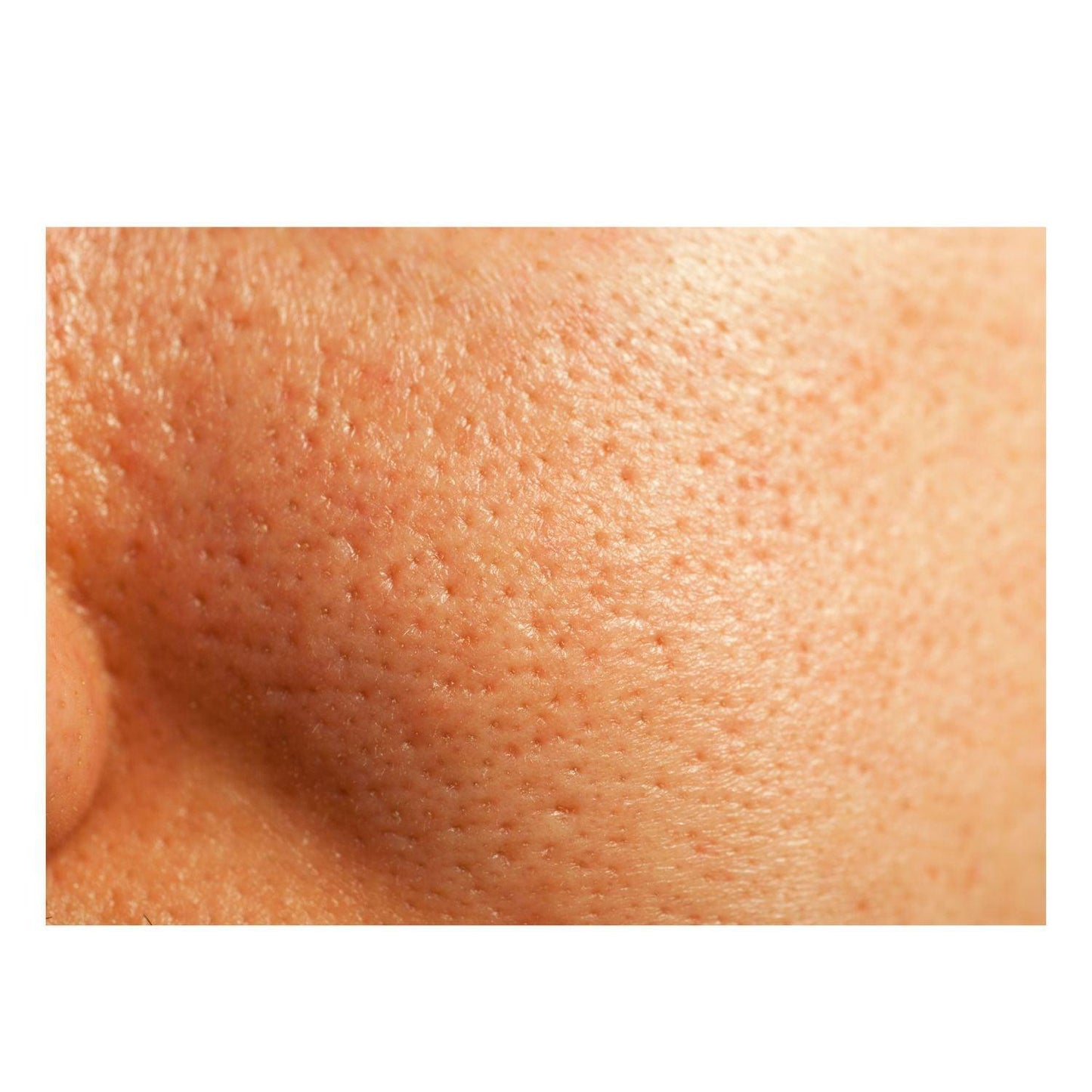 Glycolic + Lactic Acid Resurfacing Peel