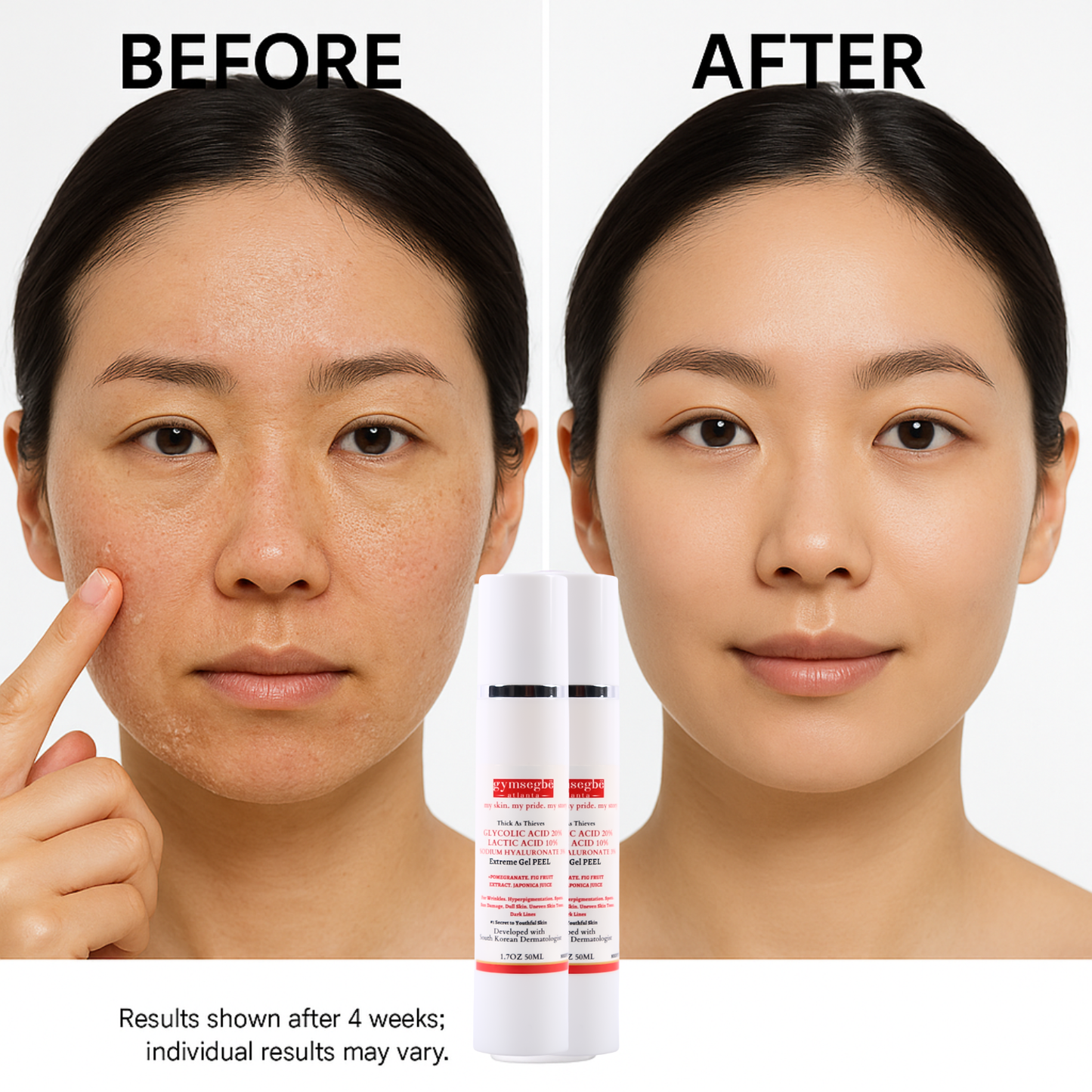 Glycolic + Lactic Acid Resurfacing Peel